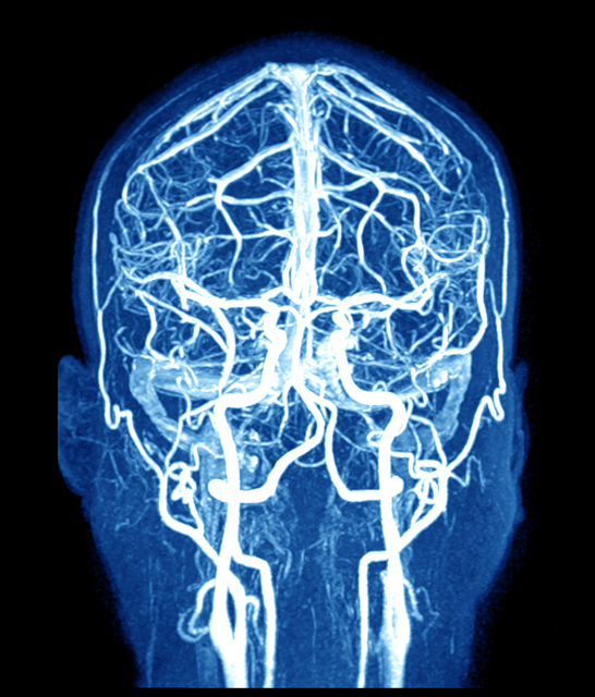 MRI mozga i cerebralnih sudova
