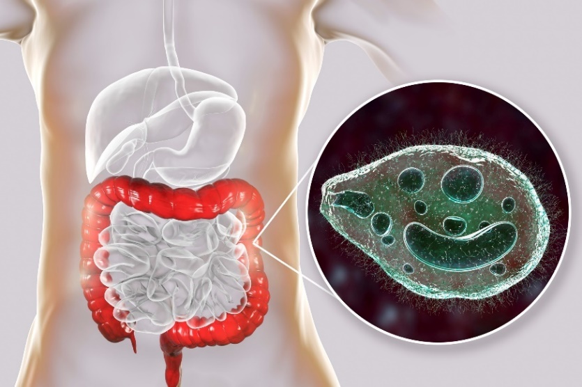 Balantidum coli –  parazit koji napada debelo crevo ljudskog digestivnog trakta.