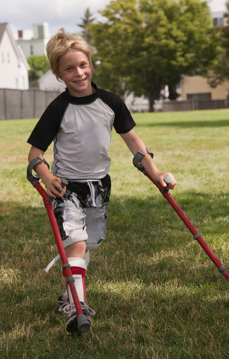 Dete sa DCP i protetskim pomagalom za hodanje