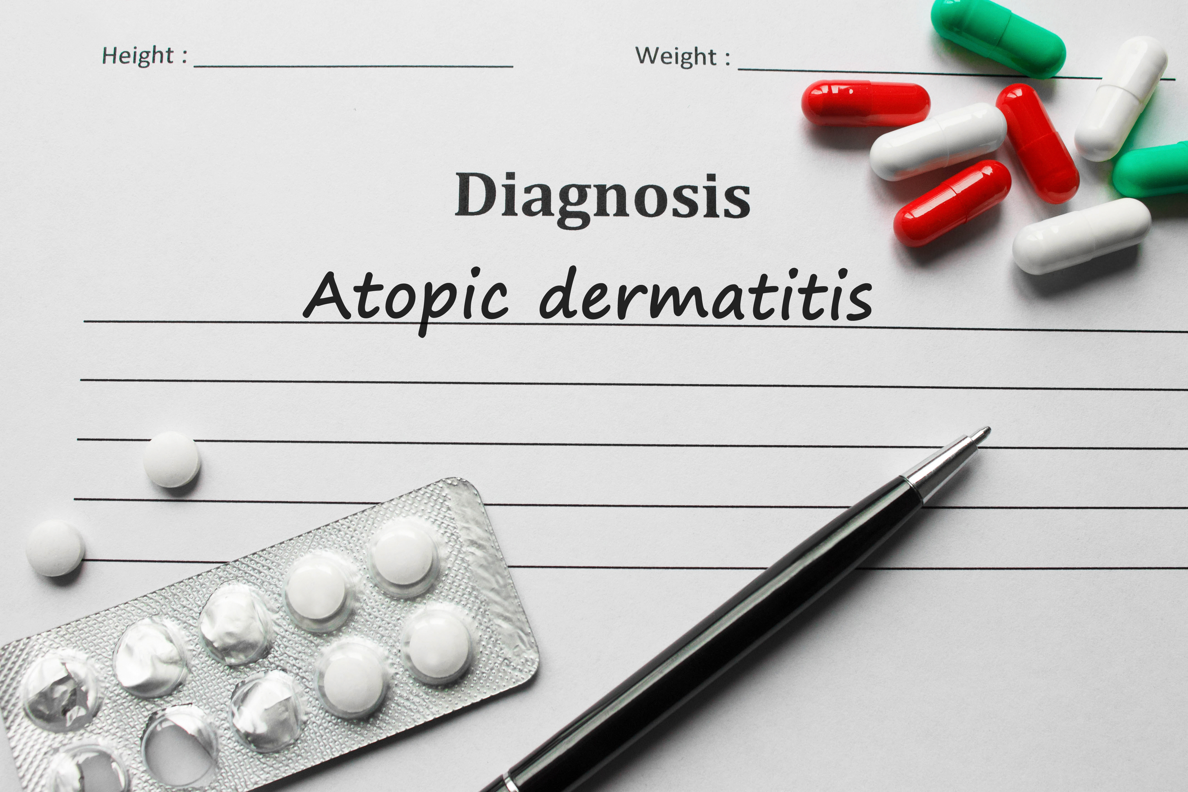 Diagnóza atopická dermatitída