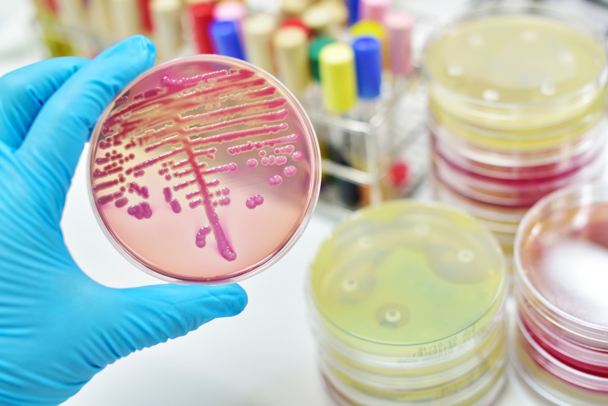 Mikrobiološki pregled – kultivacija – kolonije bakterija na posudi