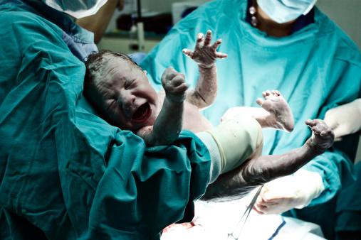 plakanje novorođenčeta u rukama lekara neposredno nakon odseka