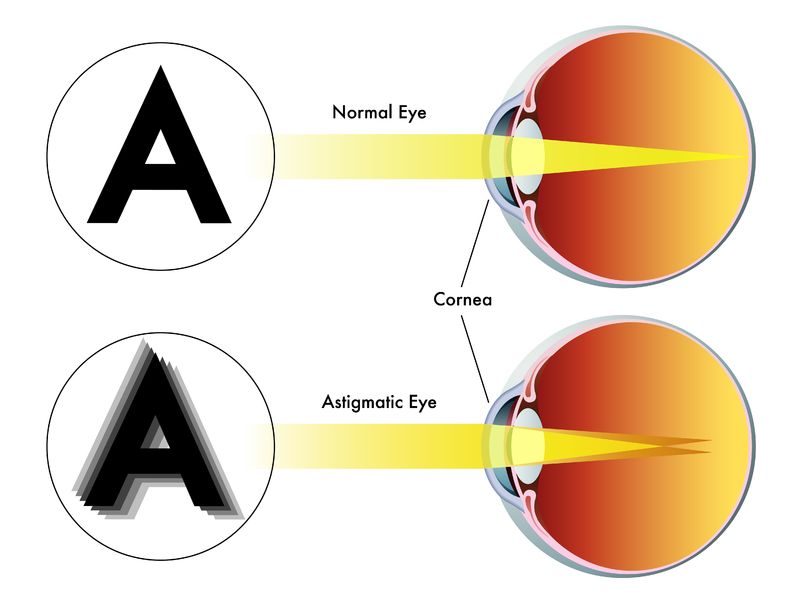 Kako slovo vidi zdravo oko u poređenju sa astigmatizmom