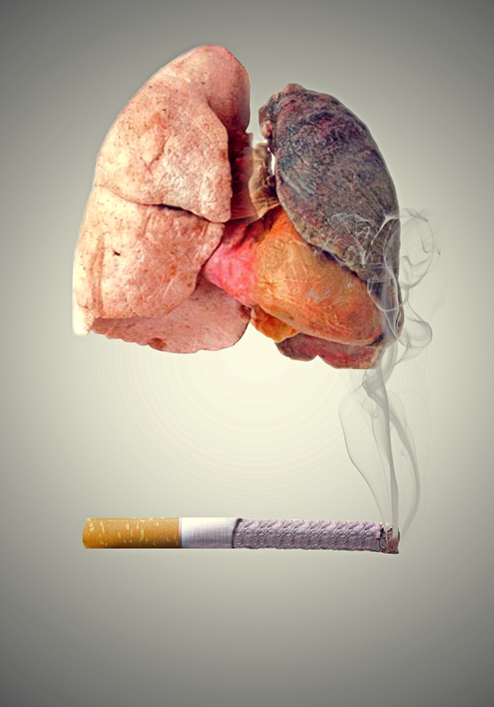 Pluća uništena pušenjem i rakom simbolična predstava
