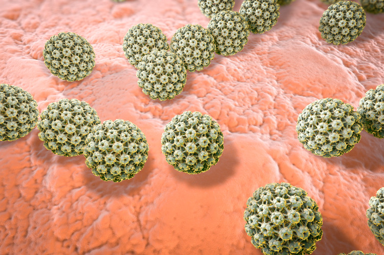 Vplyvy mikroorganizmov (konkretne vírus HPV) vírusové bunky HPV vírusu napadajúce zdravé tkanivo