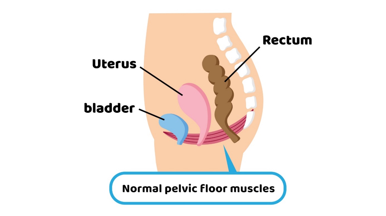 Fyziológia panvového dna voči panvovým orgánom. Uterus (maternica), Bladder (močový mechúr), Rectum (konečník). Zdroj foto: Getty Images Fyziológia panvového dna voči panvovým orgánom. Uterus (maternica), Bladder (močový mechúr), Rectum (konečník)