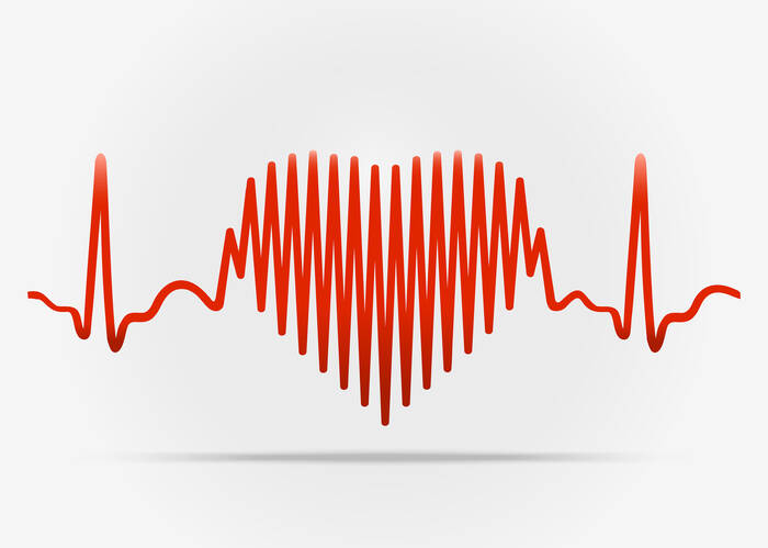 Aritmija: Šta je srčana aritmija i kako se manifestuje? + Lečenje