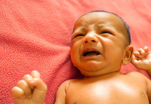 Kada je novorođenačka žutica opasna? Žutica kod novorođenčadi