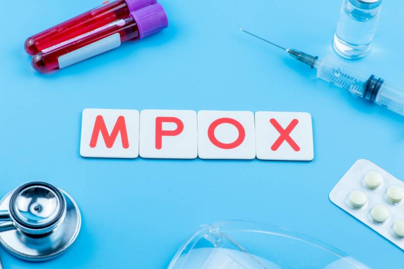 Mpox: vírus/ochorenie známe tiež ako Monkeypox - opičie kiahne. Príznaky a prenos