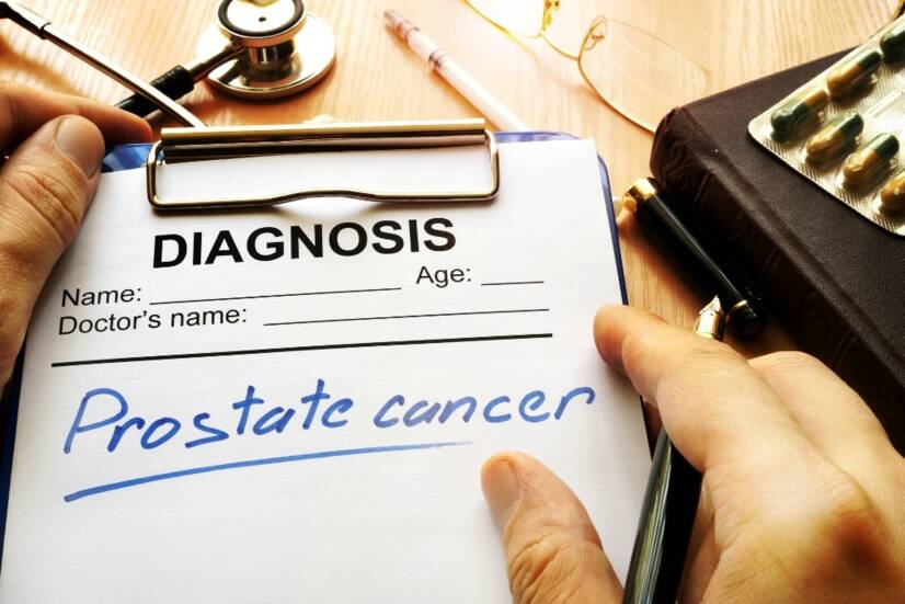 Rak prostate: uzroci i prvi simptomi. Kakva je prognoza lečenja?