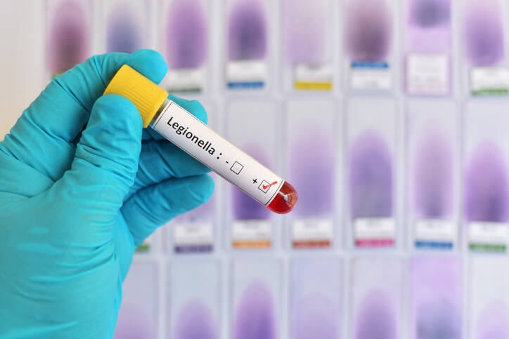 Legionella v domácom vodovode? Ako sa prejavuje, môže nás ohroziť?