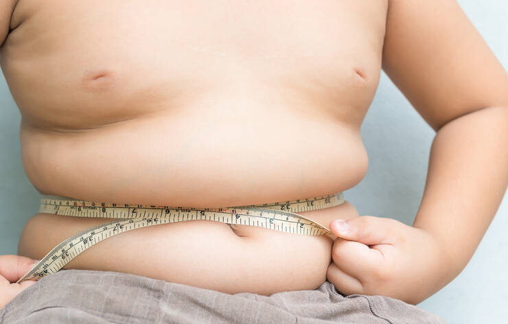 Nadváha a obezita u detí, v puberte i mladých. Čo proti nej robiť?