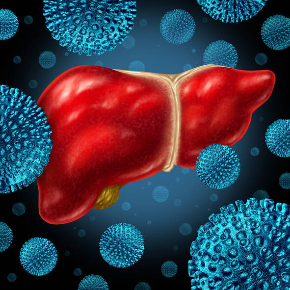 Čo je to infekčná žltačka a ako sa prenáša? (Hepatitída typu A/B/C/D)