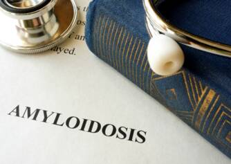 Amiloidoza: šta je to i zašto se javlja, koji su njeni simptomi?