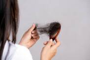 Alopecija (stanje opadanja ili gubitka kose): koji su njeni uzroci i simptomi?