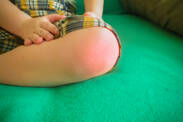 Juvenilni idiopatski artritis: Simptomi reumatizma, artritisa kod dece?