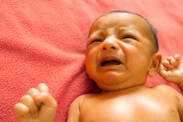 Kada je novorođenačka žutica opasna? Žutica kod novorođenčadi
