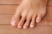 Deformisani nokti - koji su njihovi najčešći uzroci?