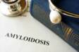 Amiloidoza: šta je to i zašto se javlja, koji su njeni simptomi?